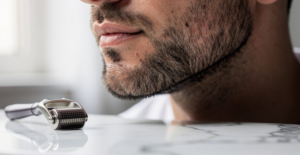 dermaroller barbe résultat