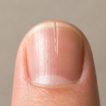 Pourquoi mon ongle se fend toujours au même endroit et comment le réparer ?